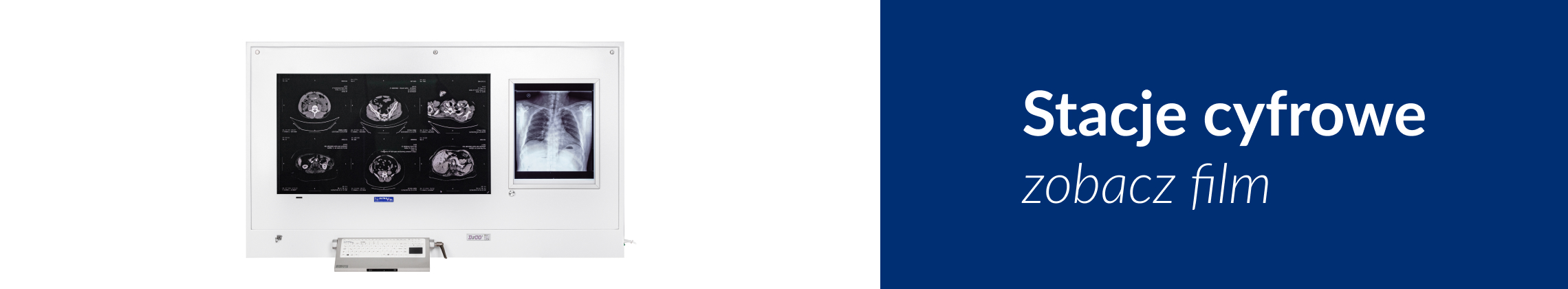 Stacje cyfrowe Stacje cyfrowe